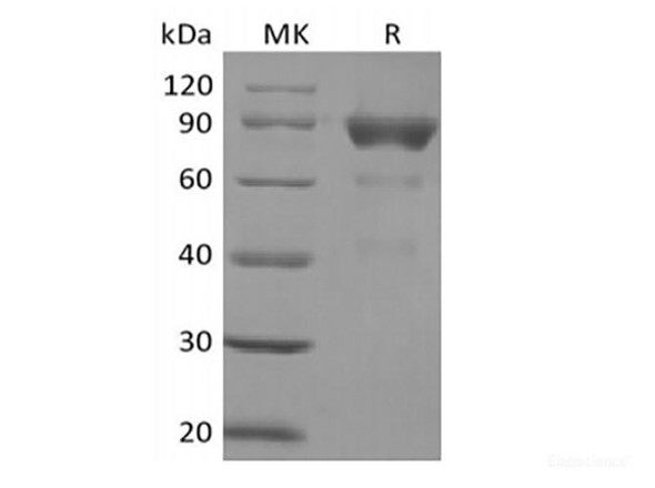 Recombinant Human SIRPB2 (C-Fc) (RPES6276)