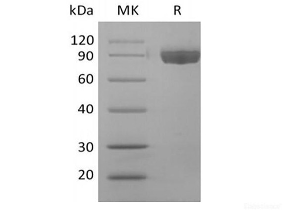 Recombinant Human Afamin/AFM (C-6His) (RPES6292)