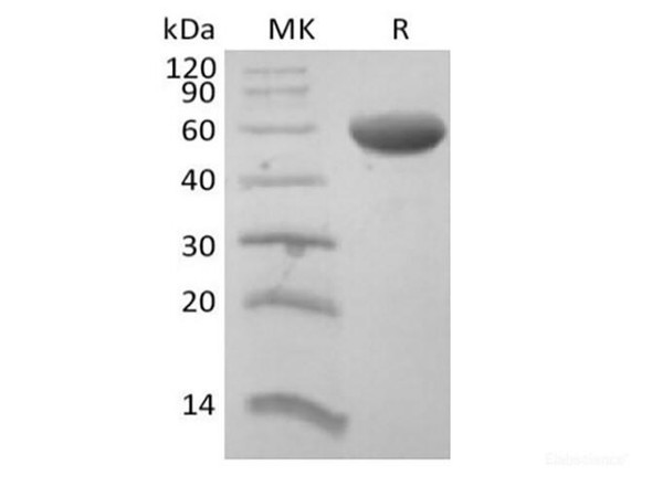 Recombinant Human CD8 Beta Chain/CD8B (C-Fc) (RPES6293)