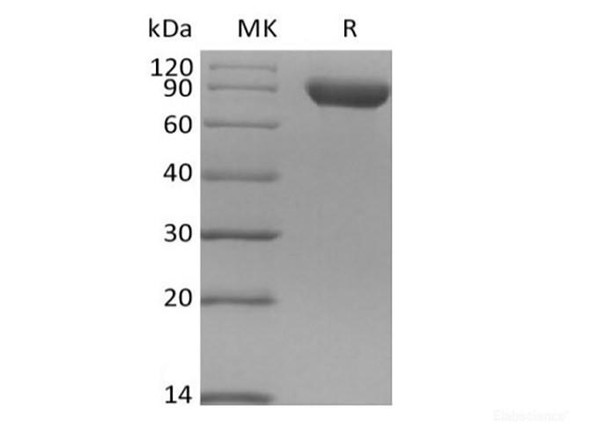 Recombinant Human Siglec-8 (C-Fc) (RPES6300)