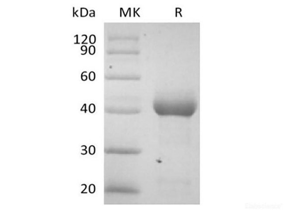 Recombinant Human Activin RIA/ALK-2 (C-Fc) (RPES6317)