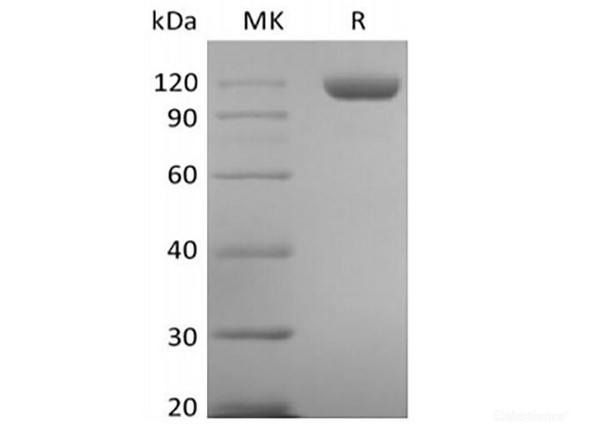 Recombinant Human Tie-2 (C-6His) (RPES6341)