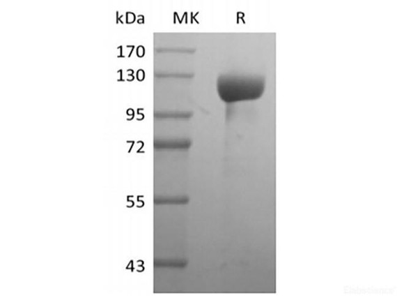 Human Receptor Tyrosine-Recombinant Protein Kinase ErbB-3/HER3 (C-Fc) (RPES6343)