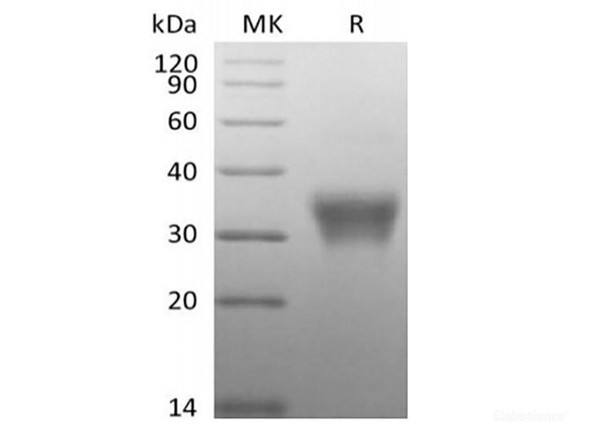 Recombinant Human CD7/Leu-9 (C-6His-Avi) Biotinylated (RPES6352)
