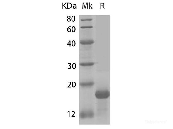 Human IL-21 Recombinant Protein (RPES6536)