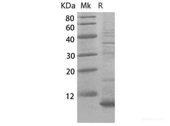 Human CCL15/MIP-5/LKN-1 (68 aa) Recombinant Protein (RPES6550)