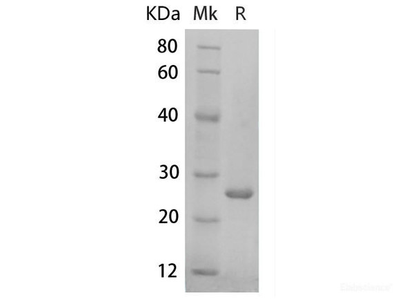Human FGF8 Recombinant Protein (RPES6551)