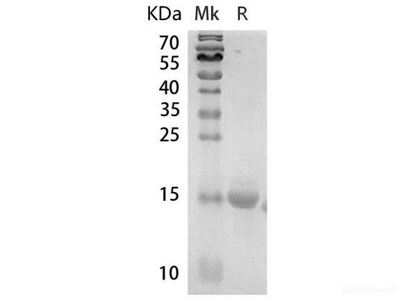 Human MKI67 Recombinant Protein (RPES6562)