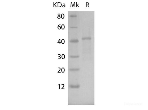 Human GSK3Î± Recombinant Protein (RPES6565)