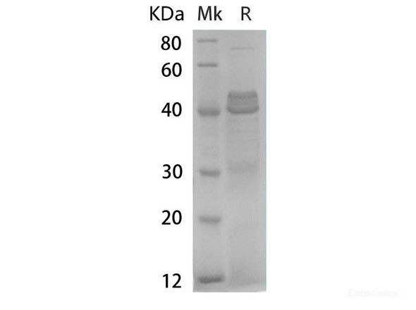 Human TGFÎ²1 Recombinant Protein (RPES6566)
