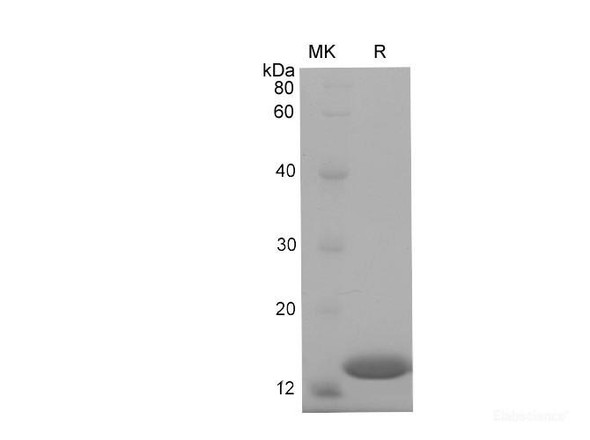 Mouse RBP1 Recombinant Protein (His Tag) (RPES6627)