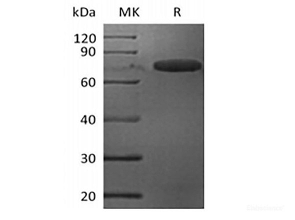 Recombinant Mouse Leukocyte Ig-Like Receptor B4/LILRB4/CD85k/ILT3 (C-Fc) (RPES6629)
