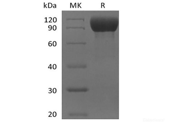 Recombinant Mouse IL-1 Receptor-Like 2/IL-1RL2/IL-1Rrp2/IL-36R (C-Fc) (RPES6634)