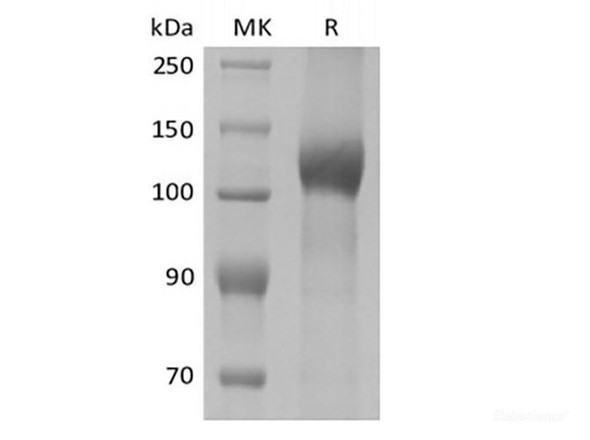 Recombinant Mouse Leptin Receptor/LEPR/CD295 (C-10His) (RPES6651)