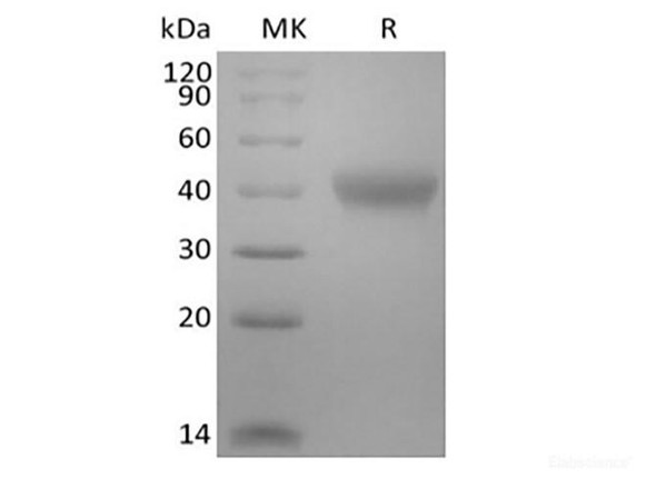 Recombinant Mouse TNF Receptor II/TNF RII/TNFRSF1B/CD120b  (C-6His-Avi) Biotinylated (RPES6668)