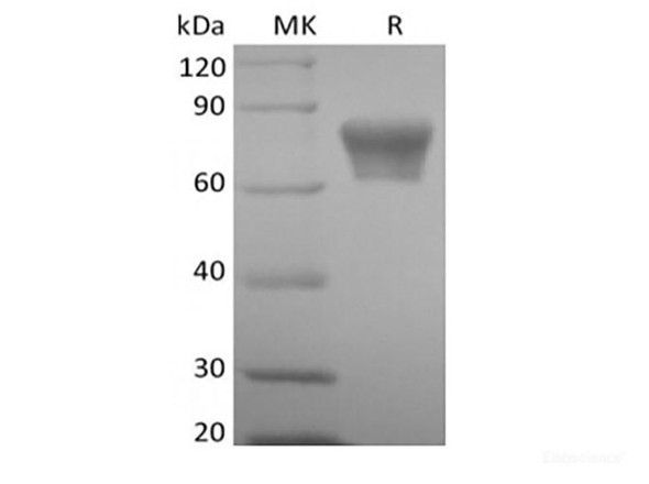 Recombinant Mouse TNF Receptor II/TNF RII/TNFRSF1B/CD120b  (C-Fc) (RPES6676)