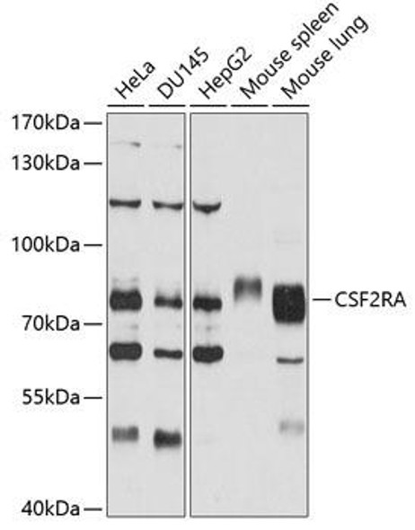 Anti-CSF2RA Antibody (CAB2034)