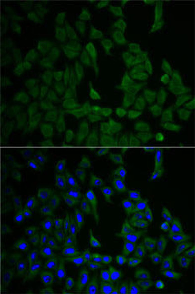 Anti-NF2 Antibody (CAB2456)