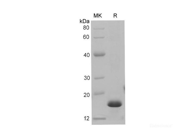 Mouse S100a9 Recombinant Protein (His Tag) (RPES6746)