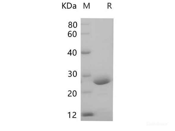 Mouse Prolactin/Prl Recombinant Protein (His Tag) (RPES6747)