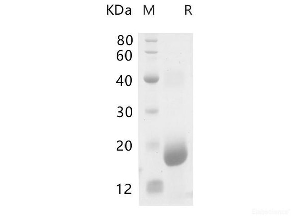 Mouse Hpgd Recombinant Protein (His Tag) (RPES6748)