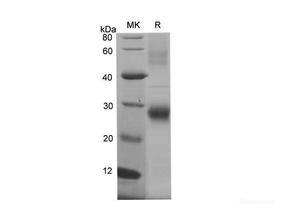 Mouse AFP Recombinant Protein (His Tag) (RPES6755)