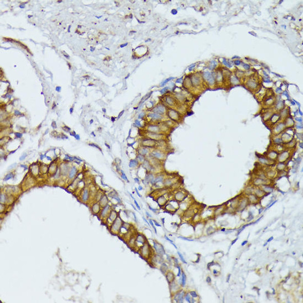 Anti-WNT1 Antibody (CAB2475)