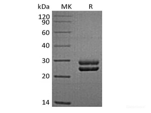 Recombinant Sheep Prolactin/PRL (C-6His) (RPES6769)