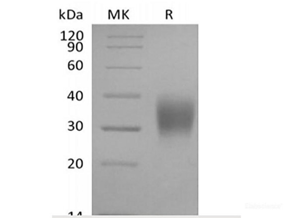 Recombinant Cynomolgus Fc  gamma RIIIA/FCGR3A/CD16a  (C-6His) (RPES6771)