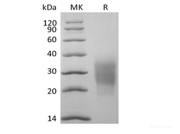 Cynomolgus NKG2-D type II Integral Membrane Recombinant Protein/NKG2D/CD314 (N-6His) (RPES6787)