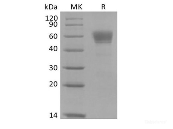Recombinant Cynomolgus IL-3 Receptor Subunit Alpha/IL-3RA/CD123 (C-Fc) (RPES6794)