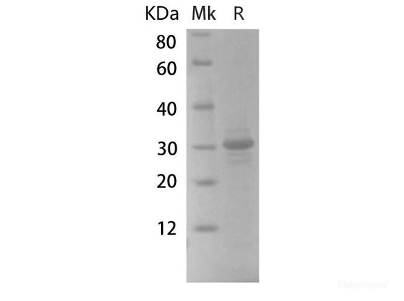 GFP Recombinant Protein (RPES6799)