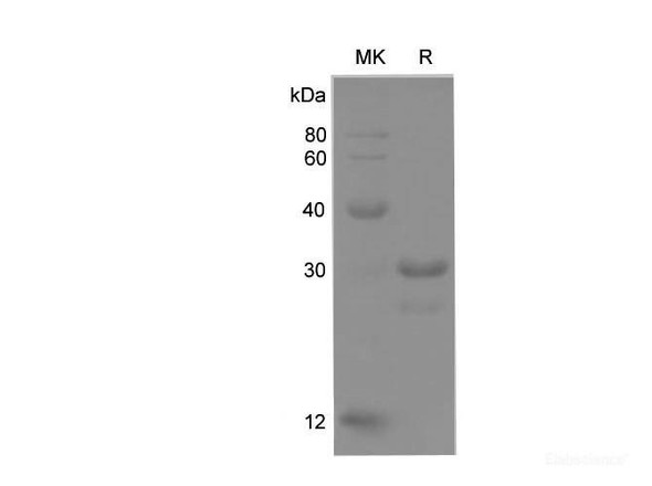 Rat Lamin B1 Recombinant Protein (His Tag) (RPES6824)