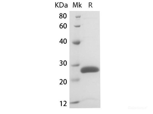 Rat IL-6 Recombinant Protein (RPES6834)