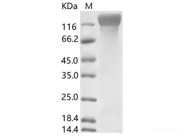 HCoV-NL63 S1 Recombinant Protein (His Tag) (RPES6877)