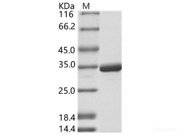 DENV-2 (strain New Guinea C) NS5 (methyltransferase domain) / Nonstructural Recombinant Protein 5 Recombinant Protein (His Tag) (RPES6897)