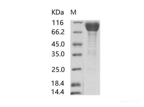 EBOV (subtype Sudan, strain Gulu) GP-RBD / GlycoRecombinant Protein Recombinant Protein (Fc Tag) (RPES6910)