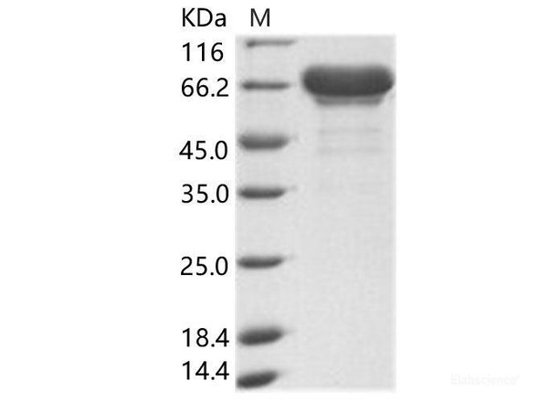 EBOV (subtype Sudan, strain Gulu) VP40 / Matrix Recombinant Protein VP40 Recombinant Protein (His & MBP Tag) (RPES6911)