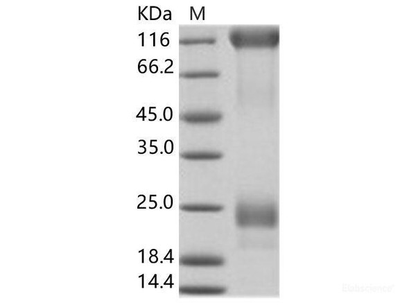 EBOV (subtype Zaire, strain Ebola virus H.sapiens-wt/SLE/2014/ManoRiver-G3686.1) GlycoRecombinant Protein Recombinant Protein (His Tag) (RPES6913)