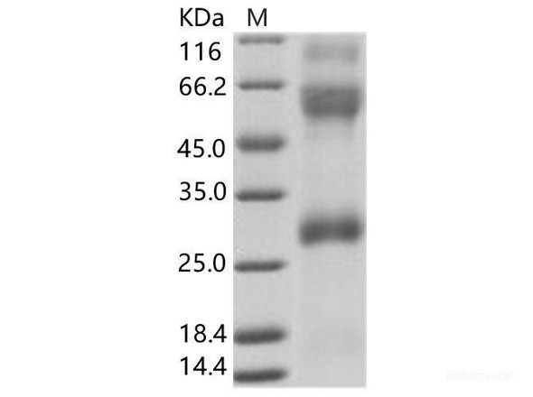 EBOV (subtype Zaire, strain H.sapiens-wt/GIN/2014/Kissidougou-C15) GlycoRecombinant Protein / GP (Virion spike glycoRecombinant Protein) Recombinant Protein (His Tag) (RPES6914)