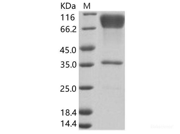 EBOV (subtype Zaire, strain H.sapiens-wt/GIN/2014/Kissidougou-C15) GlycoRecombinant Protein / GP-RBD Recombinant Protein (Fc Tag) (RPES6917)
