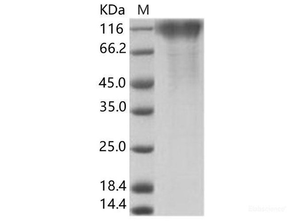 EBOV (subtype Zaire, strain H.sapiens-wt/GIN/2014/Kissidougou-C15) GP1 / GlycoRecombinant Protein Recombinant Protein (His Tag) (RPES6920)