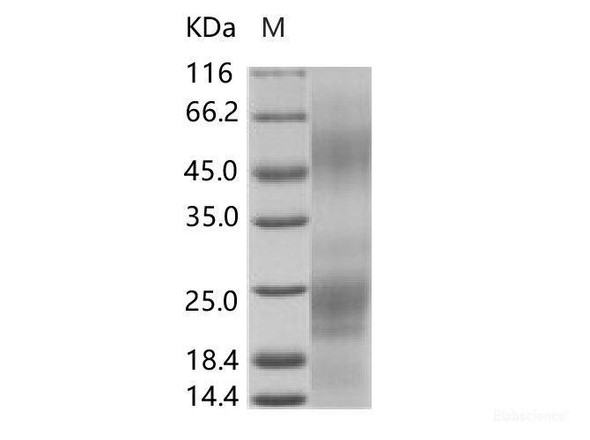 EBOV (subtype Zaire, strain H.sapiens-wt/SLE/2014/ManoRiver-G3686.1) GlycoRecombinant Protein Recombinant Protein (His Tag) (RPES6926)