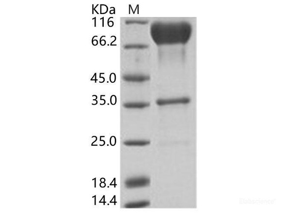 EBOV (subtype Zaire, strain Mayinga 1976) GlycoRecombinant Protein / GP-RBD Recombinant Protein (Fc Tag) (RPES6928)