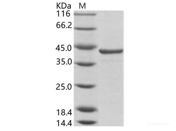 HCV (HCV-1a) NS3 protease / helicase immunodominant region Recombinant Protein (aa 1356-1459, GST Tag) (RPES6943)