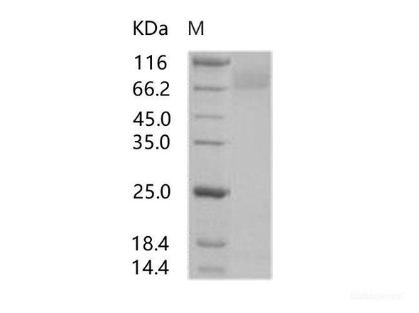HIV-1 gp140 Recombinant Protein (group P, strain RBF168) (Fc Tag) (RPES6953)