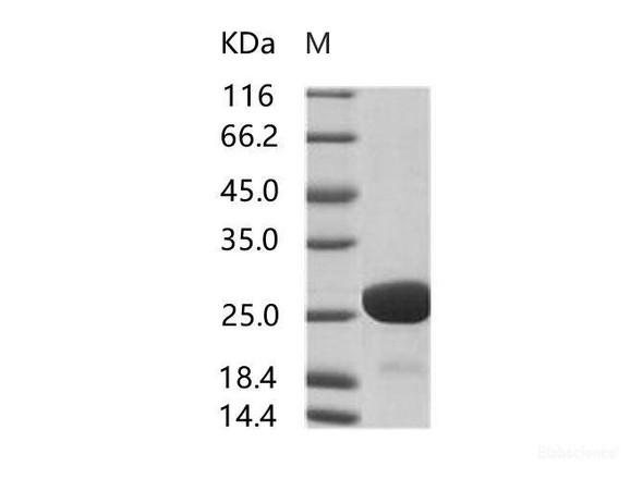 HIV-1 p24 Recombinant Protein (group M, subtype B, strain HXB2) (His Tag) (RPES6956)