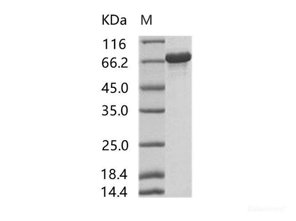 HIV-p66 / RT-p66 (group M, subtype B (isolate HXB2) Gag-Pol polyRecombinant Protein Recombinant Protein (His Tag) (RPES6963)