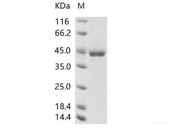 Human coronavirus (HCoV-229E) NucleoRecombinant Protein / NP Recombinant Protein (His Tag) (RPES6964)