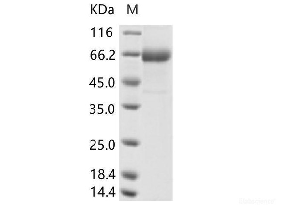 Recombinant Human parainfluenza virus 4b (HPIV-4b) Hemagglutinin-neuraminidase Recombinant (aa 48-579, His Tag) (RPES6978)